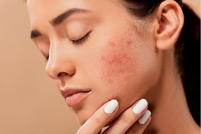comment éviter les irritations de la peau dues au masque