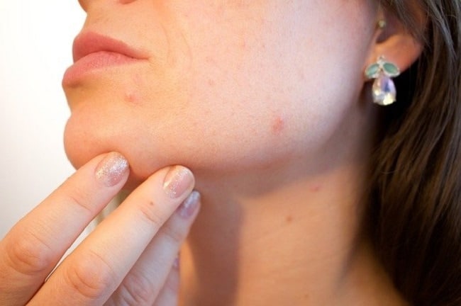 Irritation de la peau : quelles en sont les causes et comment y ...