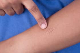 Automutilation et scarification ado, un appel au secours - MaFamilleZen