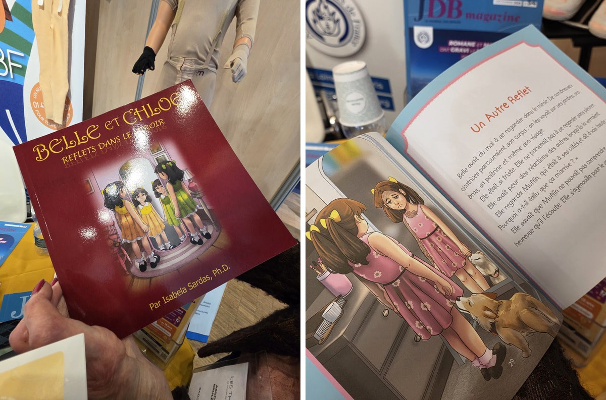 livre pour enfant grand brulé